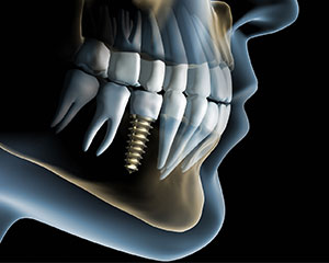 3D снимок зубов в стоматологии