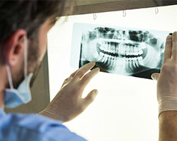 Рентген зубов